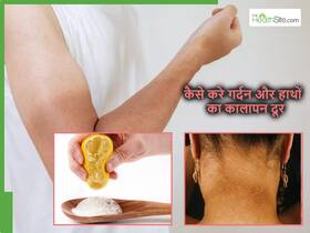 धूप से हाथों व गर्दन पर होने लगा कालापन? एक बार में ही हो जाएगा आधे से ज्यादा साफ, आजमाएं ये खास नुस्खा