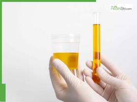 Are Darker Urine And Pale Stools Signs Of Pancreatic Cancer? Know About Its Symptoms And Causes