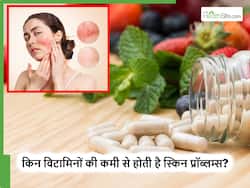 इस विटामिन की कमी से होता है चेहरा खराब, पूरी होते ही अपने आप सुधरने लगेगी स्किन