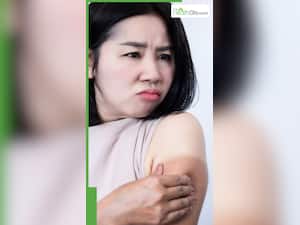 गर्मियों में टैनिंग से बचने के लिए घरेलू उपाय