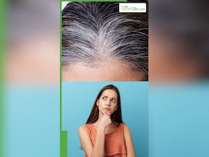 सफेद बालों को काला कैसे करें?