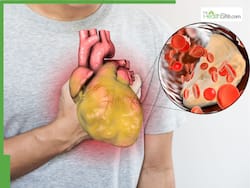 28-Year-Old Bengaluru Man Suffers Heart Attack Despite Healthy Lifestyle     Doctors Find 80% Artery Blockage