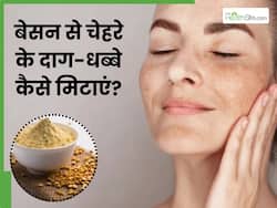 चेहरे के दाग-धब्बे मिटाने के लिए बेसन कैसे लगाएं? जानें 5 तरीके, जिनसे साफ होगी स्किन