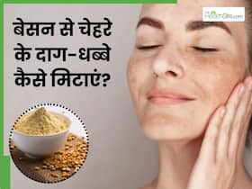 चेहरे के दाग-धब्बे मिटाने के लिए बेसन कैसे लगाएं? जानें 5 तरीके, जिनसे साफ होगी स्किन