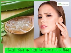 क्या ऑयली स्किन पर लगाना चाहिए एलो वेरा? जानिए गर्मियों में ऑयली स्किन की केयर के तरीके