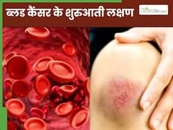 ब्लड कैंसर होने से पहले शरीर में दिखाई देते हैं ये 5 लक्षण, 99 फीसदी लोग साधारण समझकर करते हैं इग्नोर