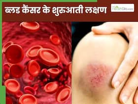 ब्लड कैंसर होने से पहले शरीर में दिखाई देते हैं ये 5 लक्षण, 99 फीसदी लोग साधारण समझकर करते हैं इग्नोर