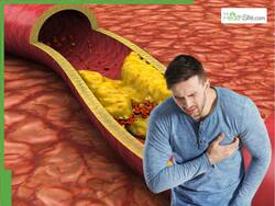 Heart Attack Prevention: 5 Proven Lifestyle Changes to Improve Heart Health Naturally