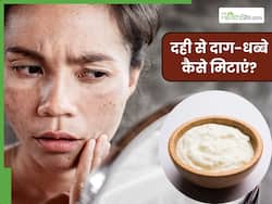 चेहरे के दाग-धब्बे मिटाने के लिए दही कैसे लगाएं? जानें 5 तरीके, जिनसे मिट जाएंगे जिद्दी काले धब्बे