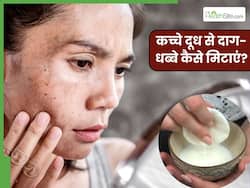 चेहरे के दाग-धब्बे मिटाने के लिए कच्चा दूध कैसे लगाएं? जानें 5 तरीके, जिनसे डार्क स्पॉट्स से मिलेगा छुटकारा