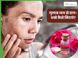चेहरे के दाग-धब्बे मिटाने के लिए गुलाब जल कैसे लगाएं? जानें 5 तरीके, जिनसे मिट जाएंगे जिद्दी डार्क स्पॉट्स