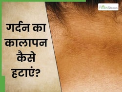 गर्दन का कालापन कैसे हटाएं? जानें 5 तरीके, जिनसे चमक उठेगी काली गर्दन