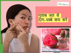 चेहरे के दाग-धब्बे कम करने के लिए किस तरह लगाना चाहिए गुलाब जल, ये 3 तरीके है बेस्ट