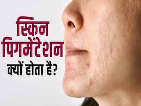 स्किन की पिगमेंटेशन का दूर करेंगे ये घरेलू उपाय