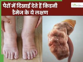 किडनी डैमेज होने से पहले पैरों में दिखाई देते हैं ये 5 लक्षण, नजरअंदाज करने की न करें भूल