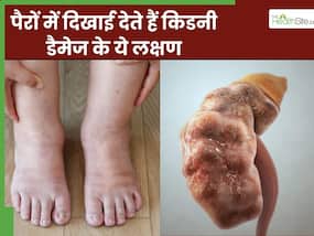 किडनी डैमेज होने से पहले पैरों में दिखाई देते हैं ये 5 लक्षण, नजरअंदाज करने की न करें भूल