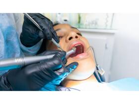 Tooth Extraction – What to Expect and Where to Get It Done Affordably Tooth Extraction – What to Expect and Where to Get It Done Affordably
