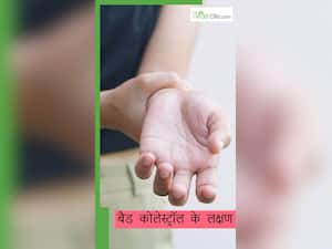 बैड कोलेस्ट्रॉल बढ़ने पर हाथों-पैरों पर दिखायी देते हैं ये 8 लक्षण