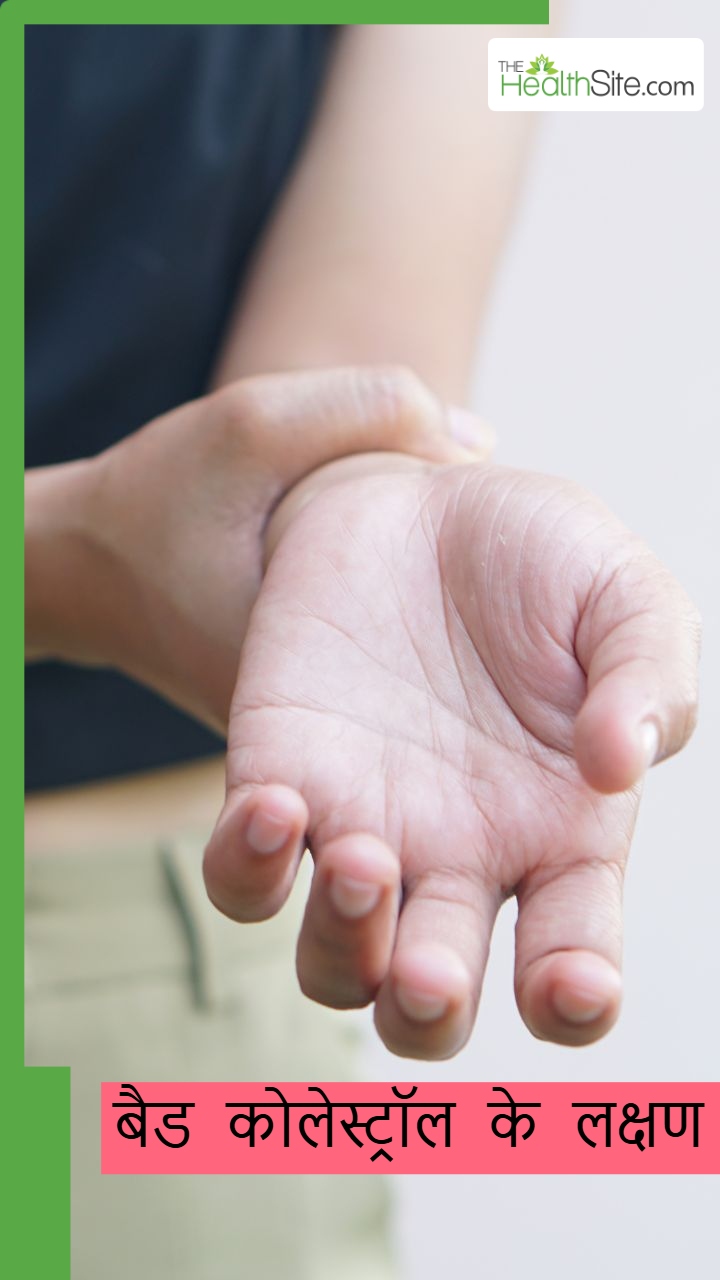बैड कोलेस्ट्रॉल बढ़ने पर हाथों-पैरों पर दिखायी देते हैं ये 8 लक्षण