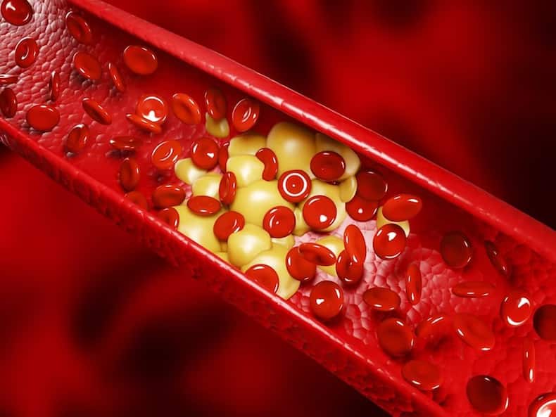 साधारण एनिमिया और थैलेसीमिया में क्या अंतर है? डॉक्टर से जानिए Thalassemia से बचाव के उपाय