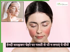 इंटरनेट पर पढ़कर गलती से भी अपने चेहरे पर न लगा लें ये 5 चीजें, पिंपल से भर जाएगा चेहरा