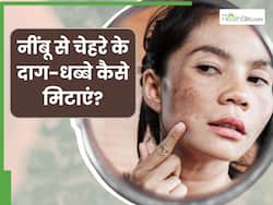चेहरे के दाग धब्बे मिटाने के लिए नींबू का रस कैसे लगाएं? जानें 5 तरीके, कम होंगे काले डार्क स्पॉट्स