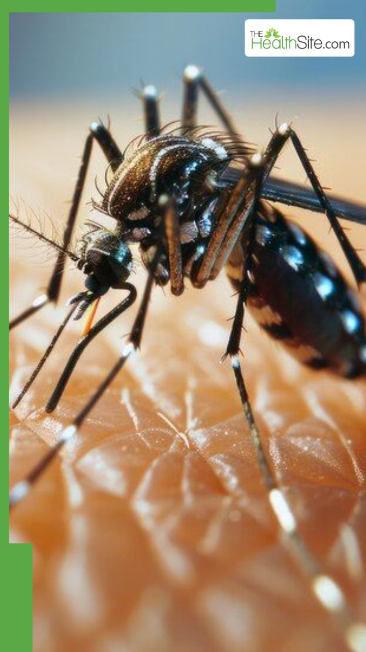 डेंगू के 7 लक्षण क्या हैं?