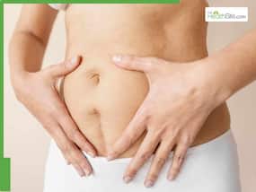 7 Best Foods That Can Help With C-Section Healing