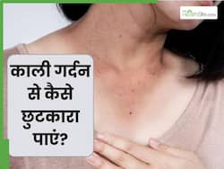 गर्मी में गर्दन हो गई है काली, तो लगाएं ये 5 चीजें, कम होगा कालापन और रंगत होगी साफ