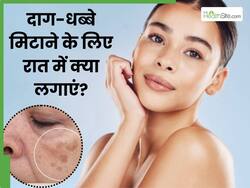 चेहरे के दाग-धब्बे मिटाने के लिए रात में क्या लगाएं? इन 5 चीजों से हल्के हो जाएंगे काले धब्बे