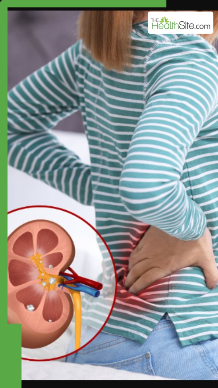 गर्मियों में किडनी को हेल्दी रखने के लिए 7 टिप्स