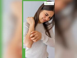 स्किन पर दिखने वाली डायबिटीज के लक्षण