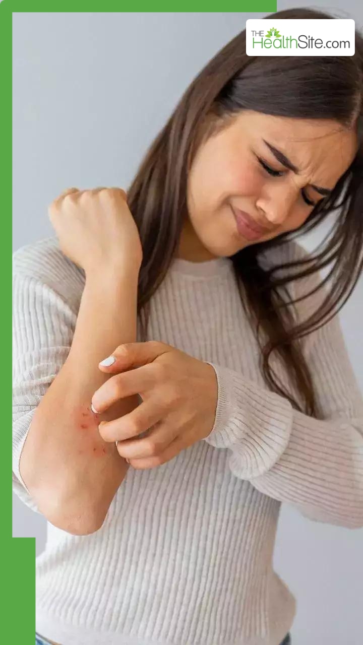 рд╕реНрдХрд┐рди рдкрд░ рджрд┐рдЦрдиреЗ рд╡рд╛рд▓реА рдбрд╛рдпрдмрд┐рдЯреАрдЬ рдХреЗ рд▓рдХреНрд╖рдг