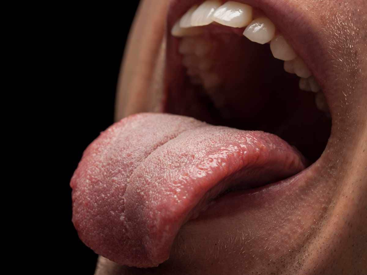 Oral cancer diagnosis, Oral Cancer, Oral cancer screening, oral cancer risk in india, Rise in oral cancer, oral cancer treatment, oral cancer risk factors, oral cancer treatment options, reconstruction surgery for oral cancer, immunotherapy for oral cancer, surgery for oral cancer