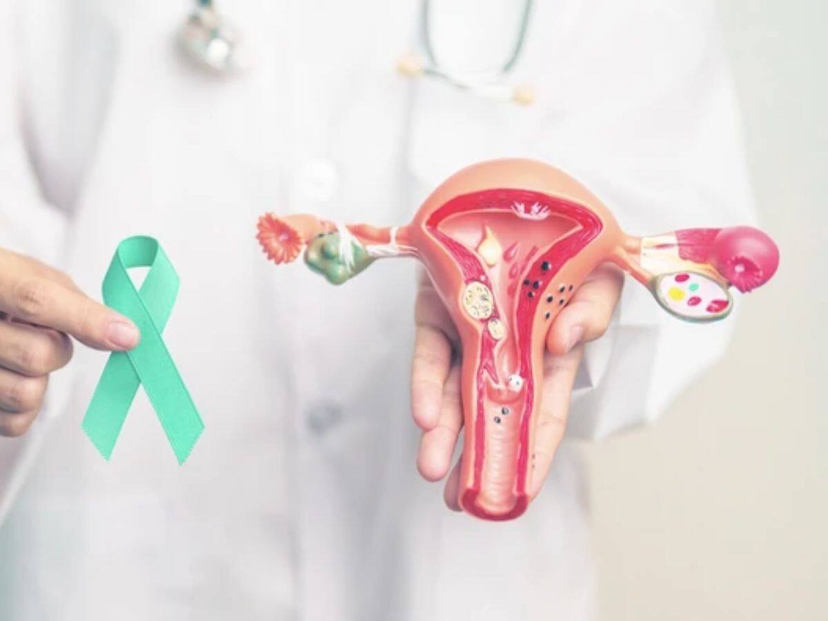 _ovarian cancer treatment