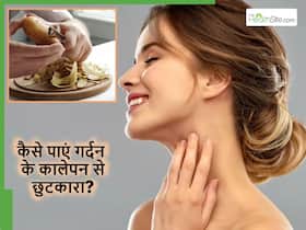 आलू का छिलका गर्दन पर घिसने से तुरंत दूर होने लगेगी टैनिंग, कूड़े में फेंकने से पहले जान लें यह खास तरीका