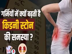 गर्मियों में क्यों बढ़ जाती है किडनी स्टोन की समस्या, जानें कैसे करें बचाव