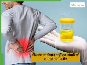 क्या आपका भी आता है गर्मियों में पीले रंग का पेशाब? इग्नोर न करें हो सकती हैं ये 5 बीमारियां