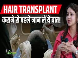 हेयर ट्रांसप्लांट कराने से पहले इन बातों पर जरूर दें ध्यान, नहीं तो होगा पछतावा