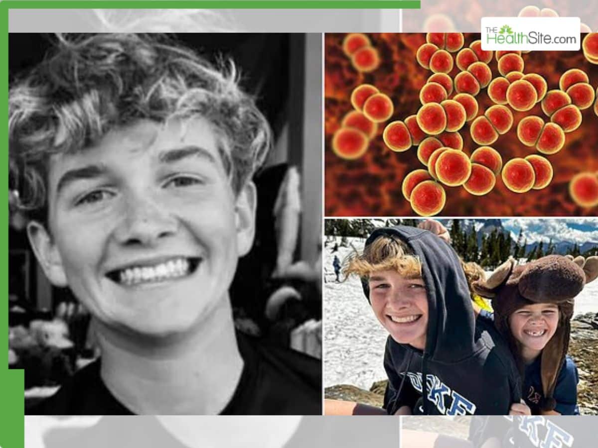 14-Year-Old Boy Dies Rare Blood Infection Meningococcemia: Doctors Warn of Flu-Like Symptoms That Can Turn Fatal