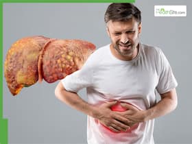 Unhealthy Liver: 6 Foods You Didn   t Know Are Bad for Your Liver     Stop Eating Them Now