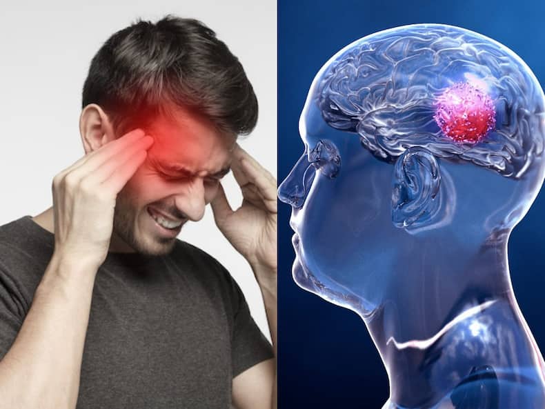 ब्रेन ट्यूमर के शुरुआती स्टेज में दिखाई देते हैं ये 5 लक्षण, दिखते ही भागें डॉक्टर के पास