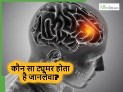 ब्रेन ट्यूमर कितने प्रकार के होते हैं और कौन सा ट्यूमर सबसे ज्यादा खतरनाक होता है? डॉक्टर से जानिए