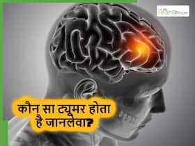 ब्रेन ट्यूमर कितने प्रकार के होते हैं और कौन सा ट्यूमर सबसे ज्यादा खतरनाक होता है? डॉक्टर से जानिए