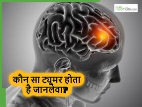 ब्रेन ट्यूमर कितने प्रकार के होते हैं और कौन सा ट्यूमर सबसे ज्यादा खतरनाक होता है? डॉक्टर से जानिए
