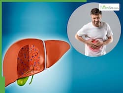 Fatty Liver Warning Signs: 7 Early Symptoms You May Be Ignoring For Minor Issues