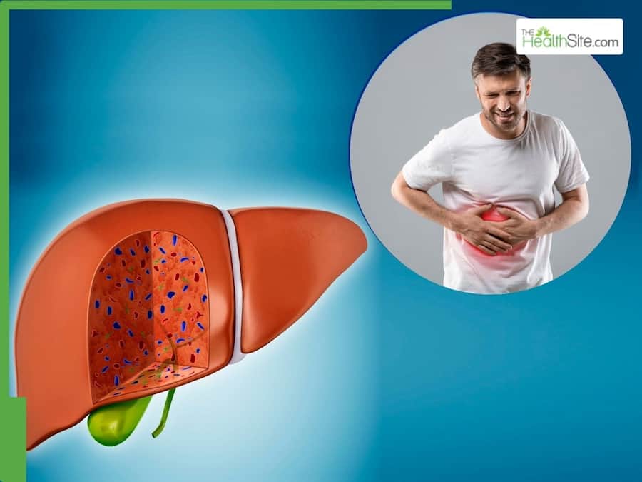 Fatty Liver Warning Signs: 7 Initial Symptoms You can ignore minor issues