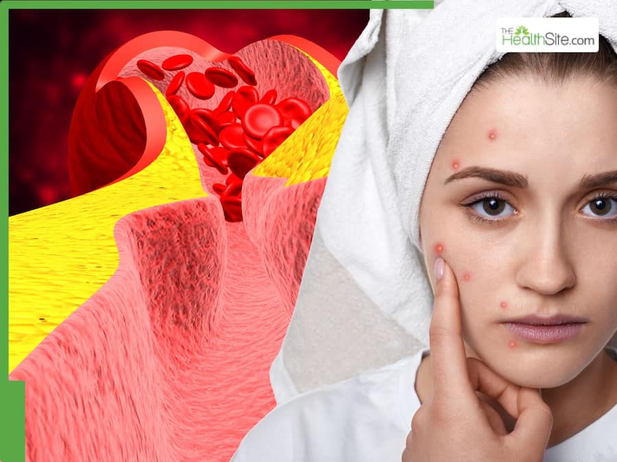 Heart Attack Warning Signs: 7 Skin symptoms are often ignored that can predict a malignant heart attack
