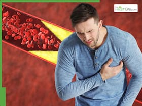 High Cholesterol Management: 6 Summer Superfoods That Can Help Unclog Blocked Arteries Naturally