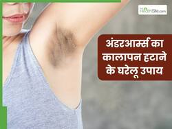 अंडरआर्म्स का कालापन हटाने के लिए अपनाएं ये 5 घरेलू उपाय, एक ही बार में दूर हो जाएगी सारी डार्कनेस